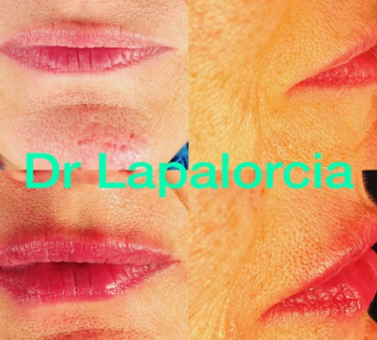 Dr Lapalorcia