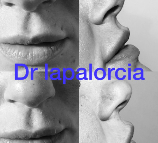Dr Lapalorcia