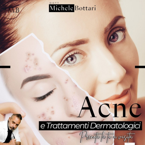 Dr. Michele Bottari Trattamenti anti acne