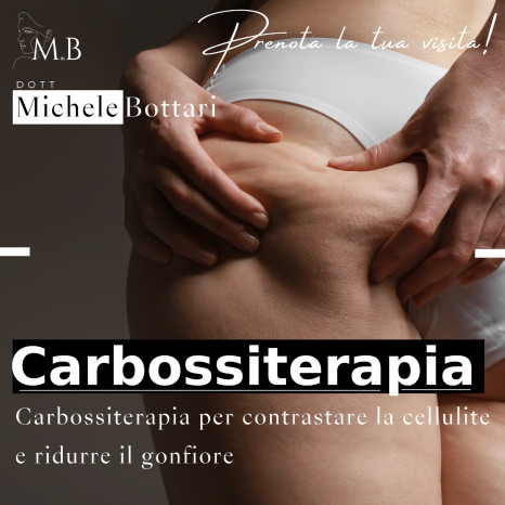 Dott. Michele Bottari Carbossiterapia